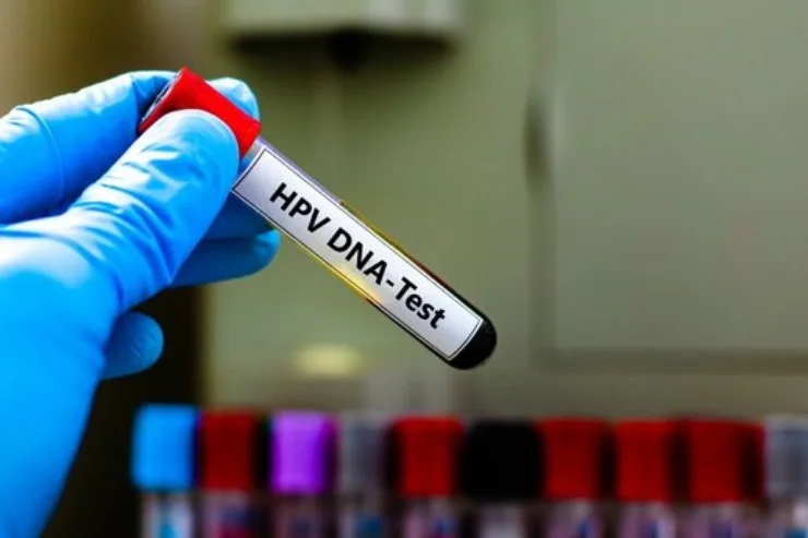 HPV DNA Testing